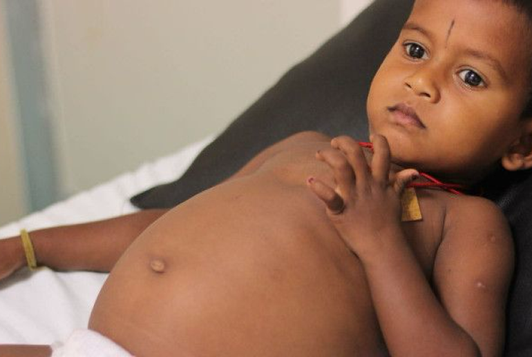 دکتر بیماری گوشه (گوچر)